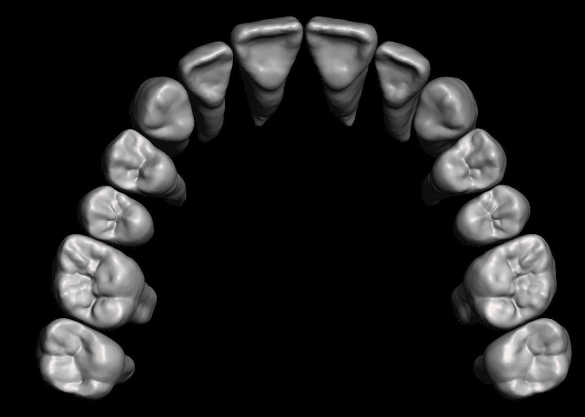 具有天然牙根和根管 3D 打印模型的牙齿解剖模型