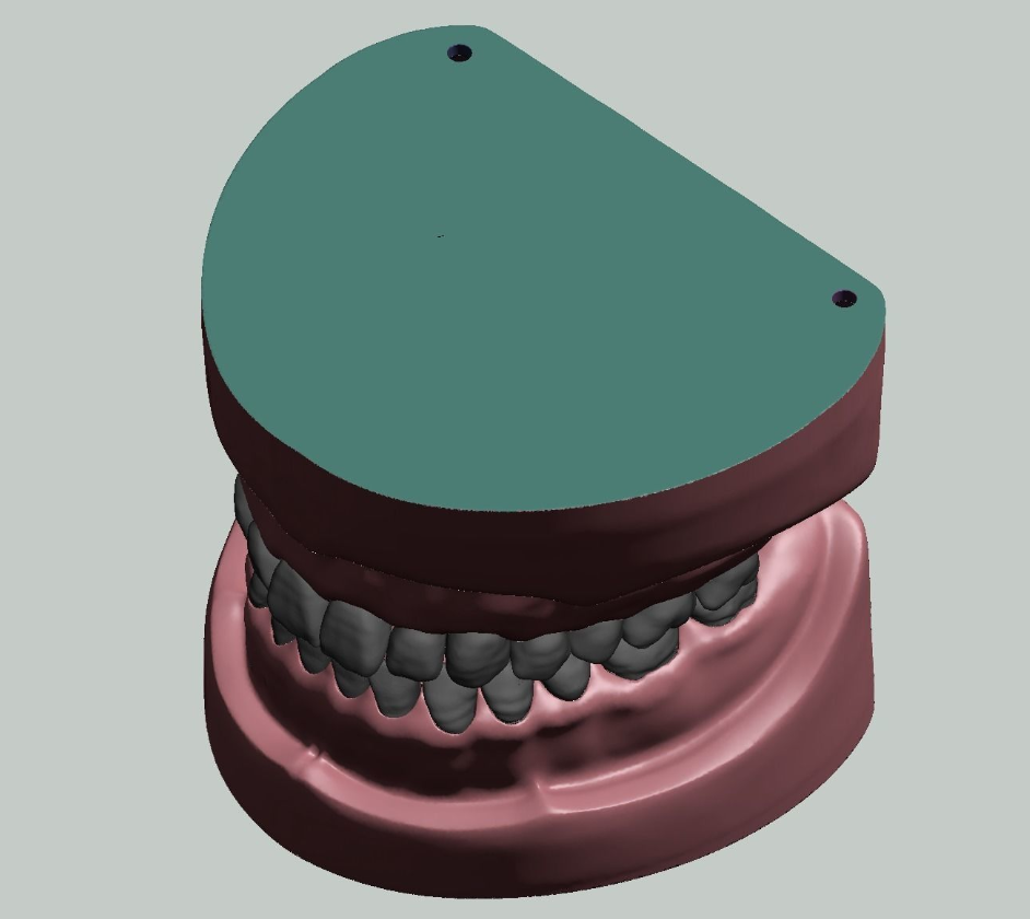 上颌和下颌牙科模型牙冠和预备模具 3D 打印模型