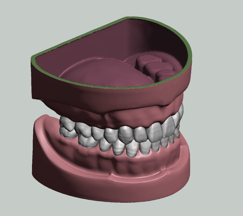 上颌和下颌牙科模型牙冠和预备模具 3D 打印模型