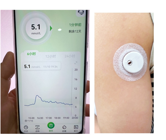 Blue-tooth Continuous Glucose Monitor(CGM)