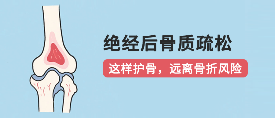 绝经后骨质疏松：这样护骨，远离骨折风险