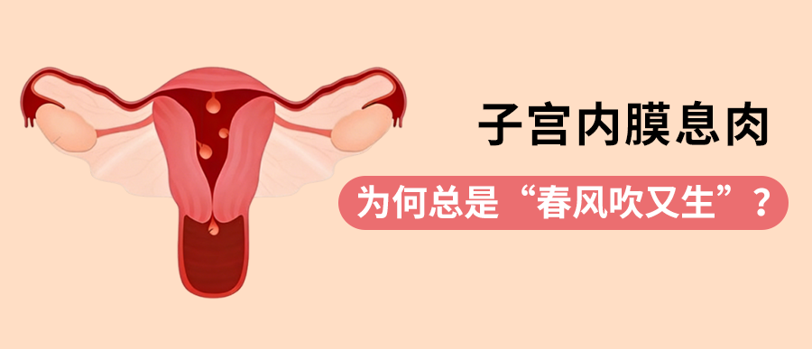 子宫内膜息肉，为何总是“春风吹又生”？医生教你如何斩草除根