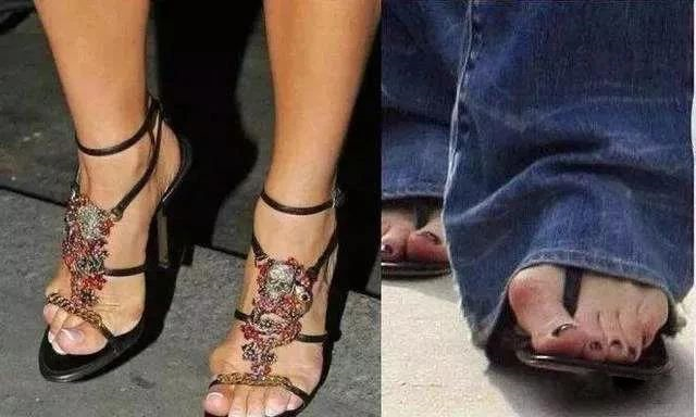 当心高跟鞋可能穿出大脚骨病