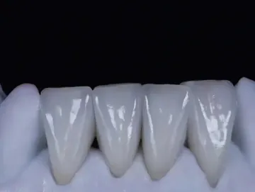 Zirconia Crowns&Bridge