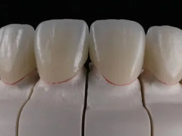 Zirconia Crowns&Bridge