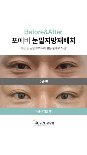 YouTube短视频