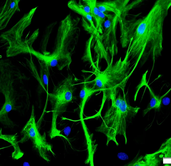 星型胶质细胞IF（GFAP）