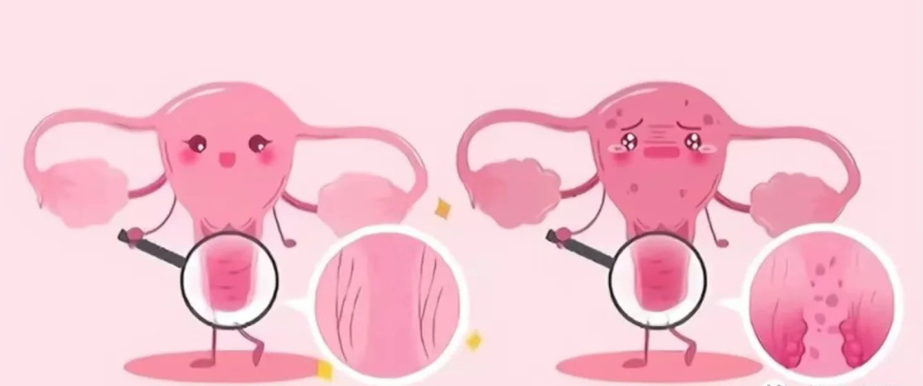 Next-Generation Cervical Cancer and Precancer Screening